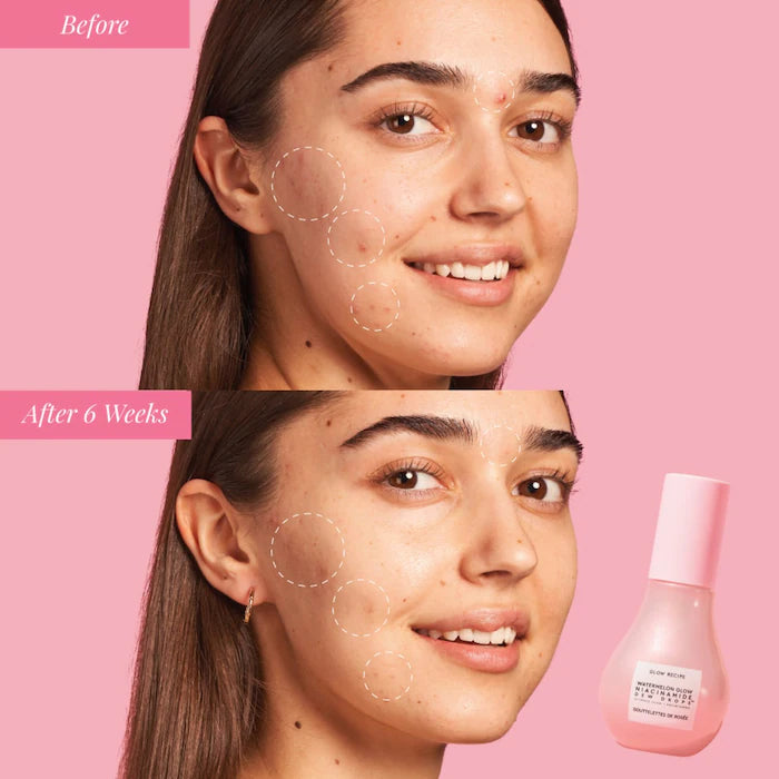 Glow Recipe Watermelon Glow Niacinamide Dew Drops Serum