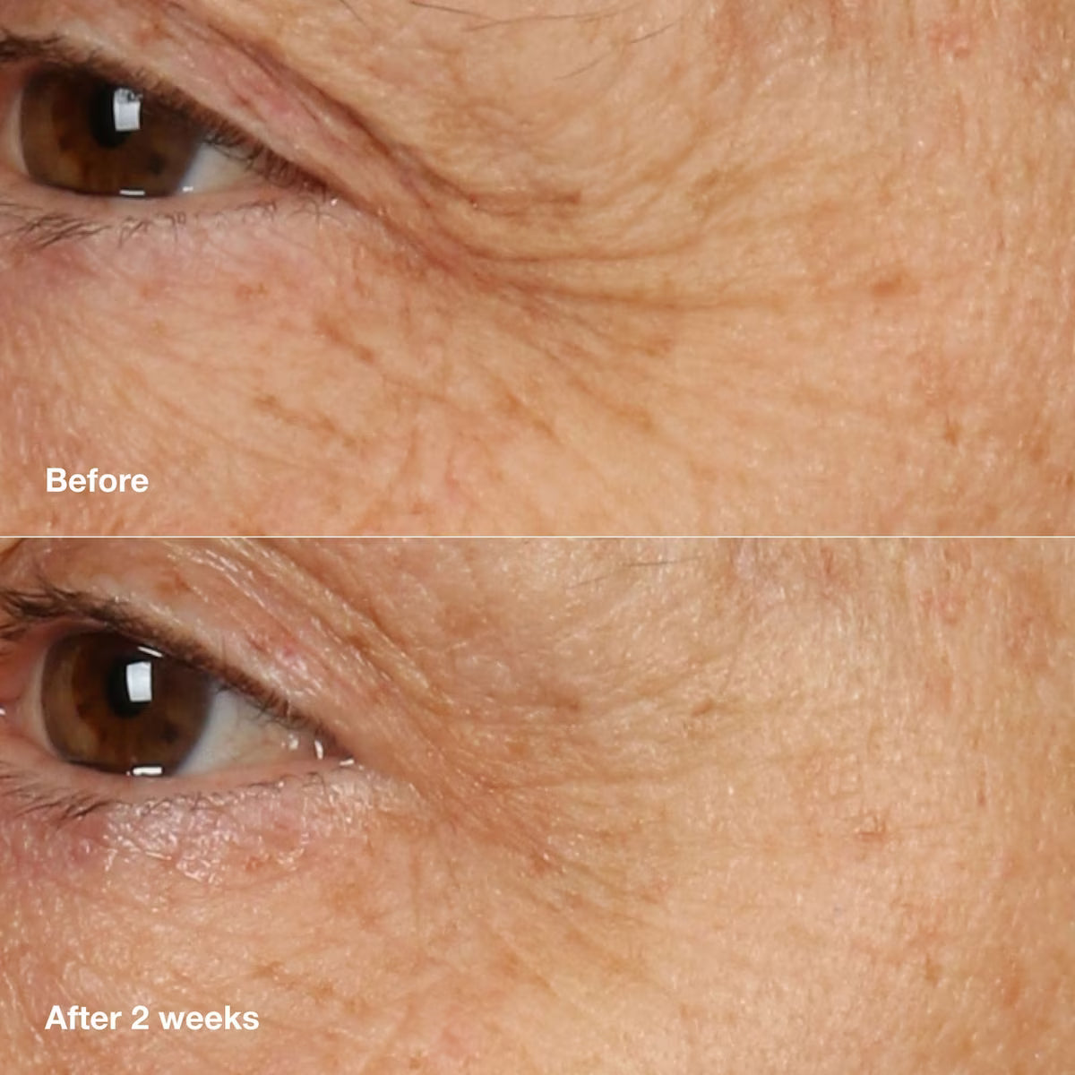 Clinique  Smart Clinical Repair™ Overnight Recovery Cream + Mask