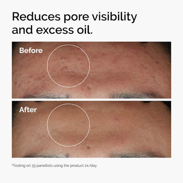 The Ordinary  Niacinamide 10% + Zinc 1%  Serum for Oily Skin 30 ml