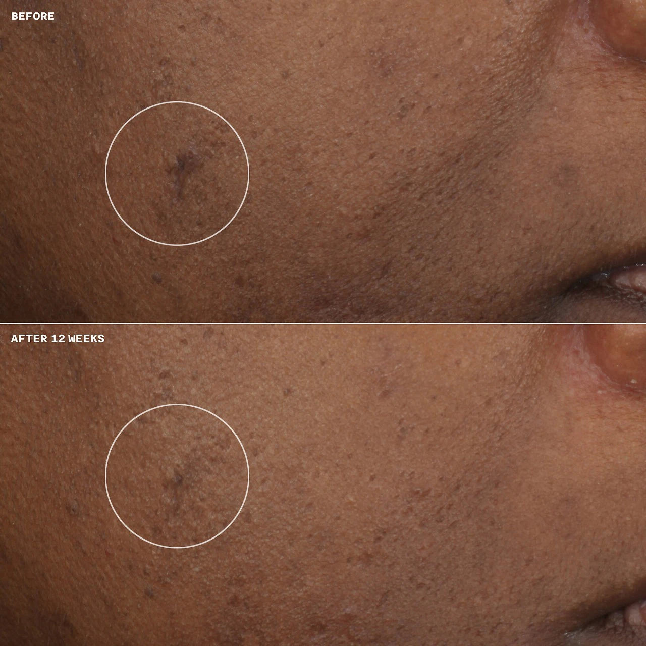 CLINIQUE  Even Better Clinical™ Brightening Moisturizer with Vitamin C 50 ml