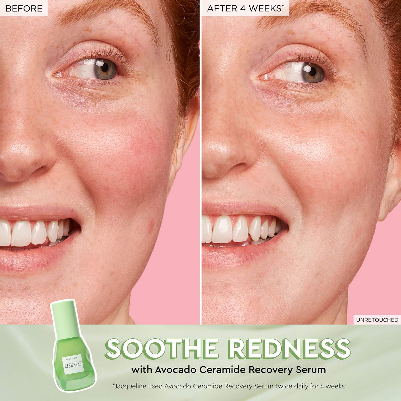 Glow Recipe  Fruit Babies Mini Best Sellers Set