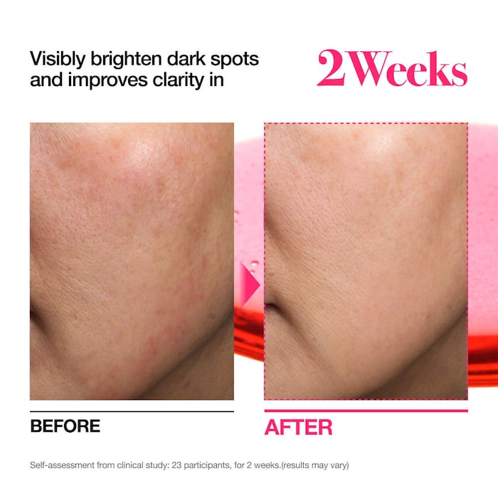 Anua  Niacinamide 10 + TXA 4 Serum